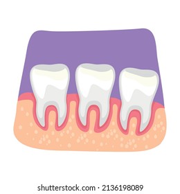 Teeth inflammation 2D vector isolated illustration. Inflamed gums flat sticker on cartoon background. Bacterial infection. Gingivitis risk colourful scene for mobile, website, presentation