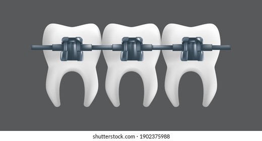 Teeth with metal braces. Orthodontic treatment concept. 3d realistic vector illustration of a dental ceramic model isolated on a grey background