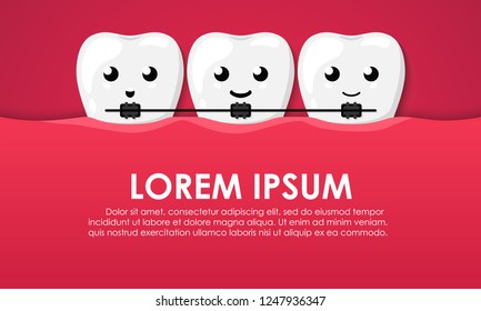 Teeth in the mouth. Orthodontic treatment (braces on teeth). Clean happy and smiling. Cute cartoon character. Dental health. Simple cartoon design. Flat style vector illustration.