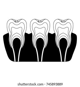 teeth with nerve and tooth root view in black silhouette vector illustration