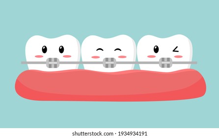 Teeth with orthodontic bracket cartoon in flat design. Dental orthodontic treatment.