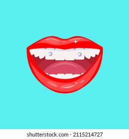 Teeth piercing with diamonds. Female mouth with snow-white teeth. Smile piercing. Decoration of teeth with jewelry stones, gem. Aesthetic dentistry. Vector illustration.