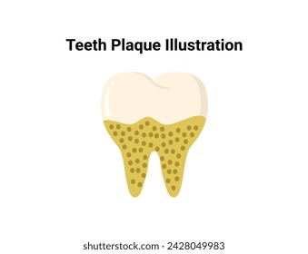 Teeth plaque illustration. Dentistry and orthodontics vector illustration. Dental clinic services, stomatology, dentistry, orthodontics, oral health care and hygiene vector.