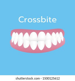 teeth problem illustration vector blue background