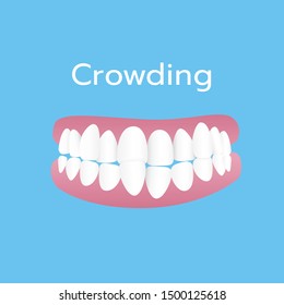 teeth problem illustration vector blue background