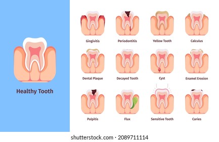 Teeth problems. Medical infographic illustrations with bad commons dental placard oral bacteria and prevention methods garish vector pictures