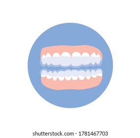 Teeth with retainers after braces. Jaws isolated. Flat vector illustration.