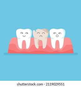 Teeth row with caries. Snow-white happy cute and yellow sad ugly tooth. Before and after whitening. Dental health concept. Vector illustration isolated on blue background.