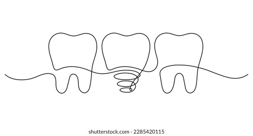 Teeth row with healthy and implant tooth, continuous art line drawing. Dentistry health. Vector hand drawn illustration