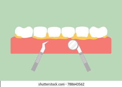 teeth scaling, dental plaque removal for cleaning - tooth cartoon vector flat style cute character for design