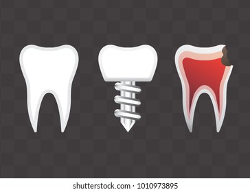 Teeth set with gradient mesh. High resolution