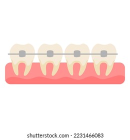 
dientes ajustados con llaves metálicas