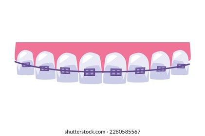 Teeth straightening with purple dental braces, flat vector illustration isolated on white background. Concepts of teeth health, dental care and orthodontic dentistry.