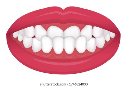 741 Underbite Images, Stock Photos & Vectors | Shutterstock