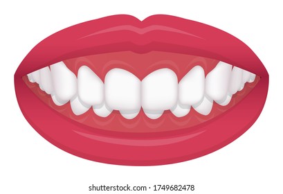 Teeth trouble ( bite type / crooked teeth ) vector illustration /Deep bite