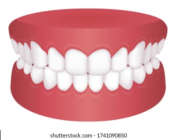 Teeth trouble ( bite type ) vector illustration /Normal Bite