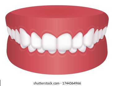 Ilustración vectorial de problemas de los dientes ( tipo mordedura ) /mordedura profunda