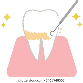 Dientes sometidos a extracción de placa y descamación