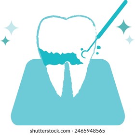 Teeth undergoing plaque removal and scaling