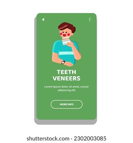 teeth veneers vector. dentistry dentist, clinic smile, denture care, medical oral, medicine treatment teeth veneers web flat cartoon illustration