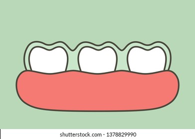 teeth wear silicone trainer or invisible braces, dental health concept - tooth cartoon vector flat style cute character for design