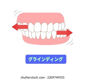 Teeth wear and TCH stress temporomandibular disorders[Translation:Types of teeth grinding]