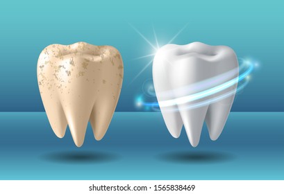 3d концепция отбеливания зубов. Сравнение чистого и грязного зуба до и после процедуры отбеливания. Плакат о процедуре отбеливания зубов, здоровье зубов и гигиене полости рта для дизайна стоматологии