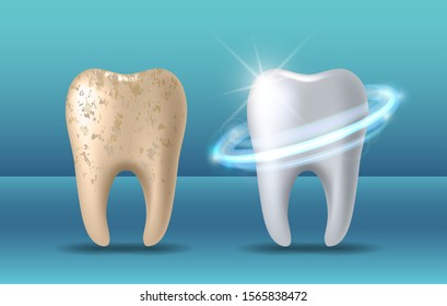 Teeth whitening 3d concept. Comparison of clean and dirty tooth before and after whitening treatment. Teeth whitening procedure, dental health and oral hygiene poster for dentistry design