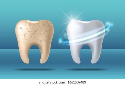 Teeth whitening 3d concept. Comparison of clean and dirty tooth before and after whitening treatment. Teeth whitening procedure, dental health and oral hygiene poster for dentistry design