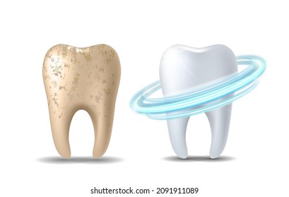 Teeth whitening 3d concept. Comparison of clean and dirty tooth before and after whitening treatment. Teeth whitening procedure, dental health and oral hygiene poster for dentistry design