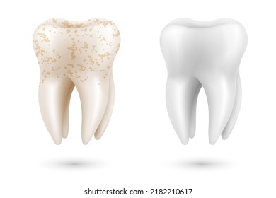 Teeth whitening 3d concept. Comparison of clean and dirty tooth before and after whitening treatment. Teeth whitening procedure, dental health and oral hygiene poster for dentistry design. Realistic v