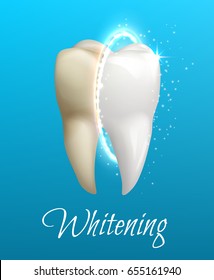 Teeth whitening 3d concept. Comparison of clean and dirty tooth before and after whitening treatment. Teeth whitening procedure, dental health and oral hygiene poster for dentistry design