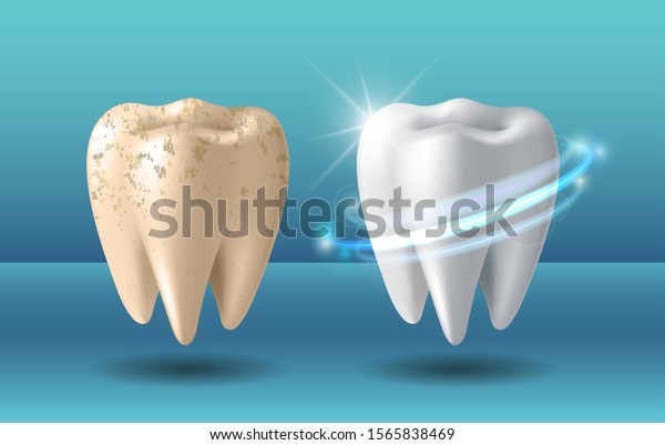Teeth\
whitening 3d concept. Comparison of clean and dirty tooth before\
and after whitening treatment. Teeth whitening procedure, dental\
health and oral hygiene poster for dentistry\
design