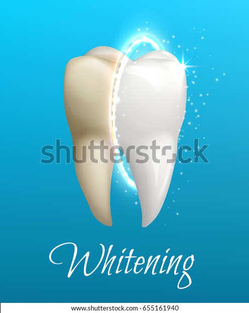 Teeth Whitening 3d Concept Comparison Clean Stock Vector (Royalty Free