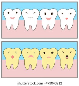 blanqueamiento de dientes antes del ejemplo. Caracteres personalizados. emociones divertidas