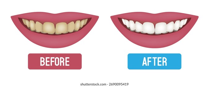 Teeth whitening. Before and after. Vector illustration.