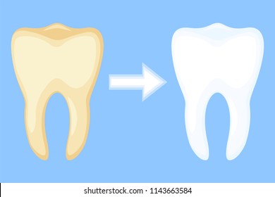 Teeth whitening concept before and after. Dirty yellow tooth becomes white. Dental care vector illustration for icon, sticker, logo, stamp, label, badge, certificate, leaflet or banner decoration