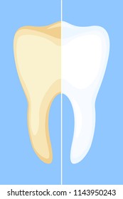 Teeth whitening concept. Dirty yellow tooth becomes white. Dental care vector illustration for icon, sticker, logo, stamp, label, badge, certificate, leaflet or banner decoration