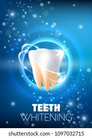 Teeth whitening concept vector realistic illustration. Tooth before and after whitening procedure on blue sparkling background. Professional teeth whitening ad design template.