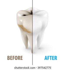 Teeth Whitening Icon, Dentist Symbol in Isometric Style on White