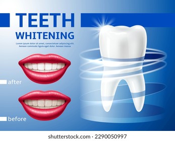 Teeth whitening poster. Realistic 3d smiling lips with perfect result, advertisement banner, cleaning and refreshing, oral hygiene poster, dentist clinic or toothpaste ad, utter vector concept