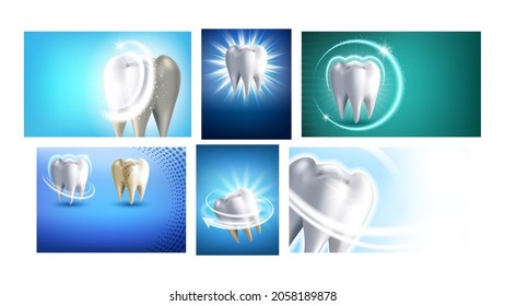 Teeth Whitening Promotional Posters Set Vector. Professional Teeth Whitening Dentist Clinic Procedure Collection Of Advertising Banners. Dental Care Style Concept Template Illustrations