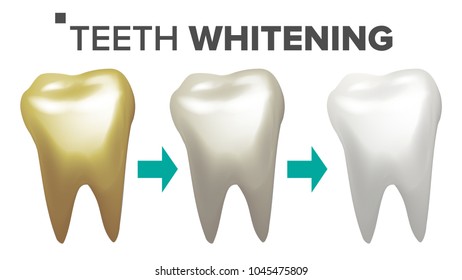 Teeth Whitening Vector. Before And After View Of Teeth Whitening. Dental Technician Concept. Isolated Illustration