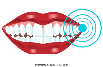 Teeth whitening, vector illustration