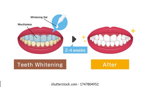 How Brush Teeth Correct Tooth Brushing Stock Vector (Royalty Free ...