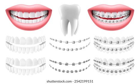 Dentes com ou sem aparelho. Aparelhos de arco sem dentes. Odontologia ortodôntica. O alinhamento dos dentes. Sorria com dentes e aparelho brancos. Vetor 3d realista isolado