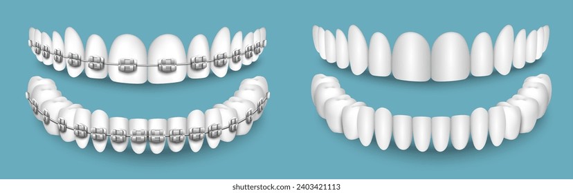 Teeth with or without braces, before and after alignment vector illustration. Orthodontic dentistry, mouth guard and dental care concept