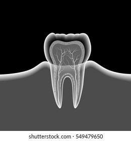 teeth x ray with vector