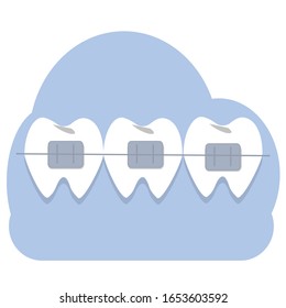 Teeths with braces vector illustration. Orthodontic, dentist, medical concep. Healthcare services.