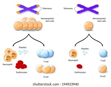 Telomere and Oncology. Aplastic anemia. Vector diagram